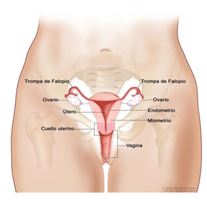 Cancer de cuello de utero